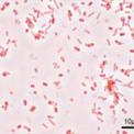 SALMONELLA