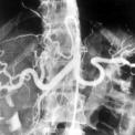 angiografia.jpg